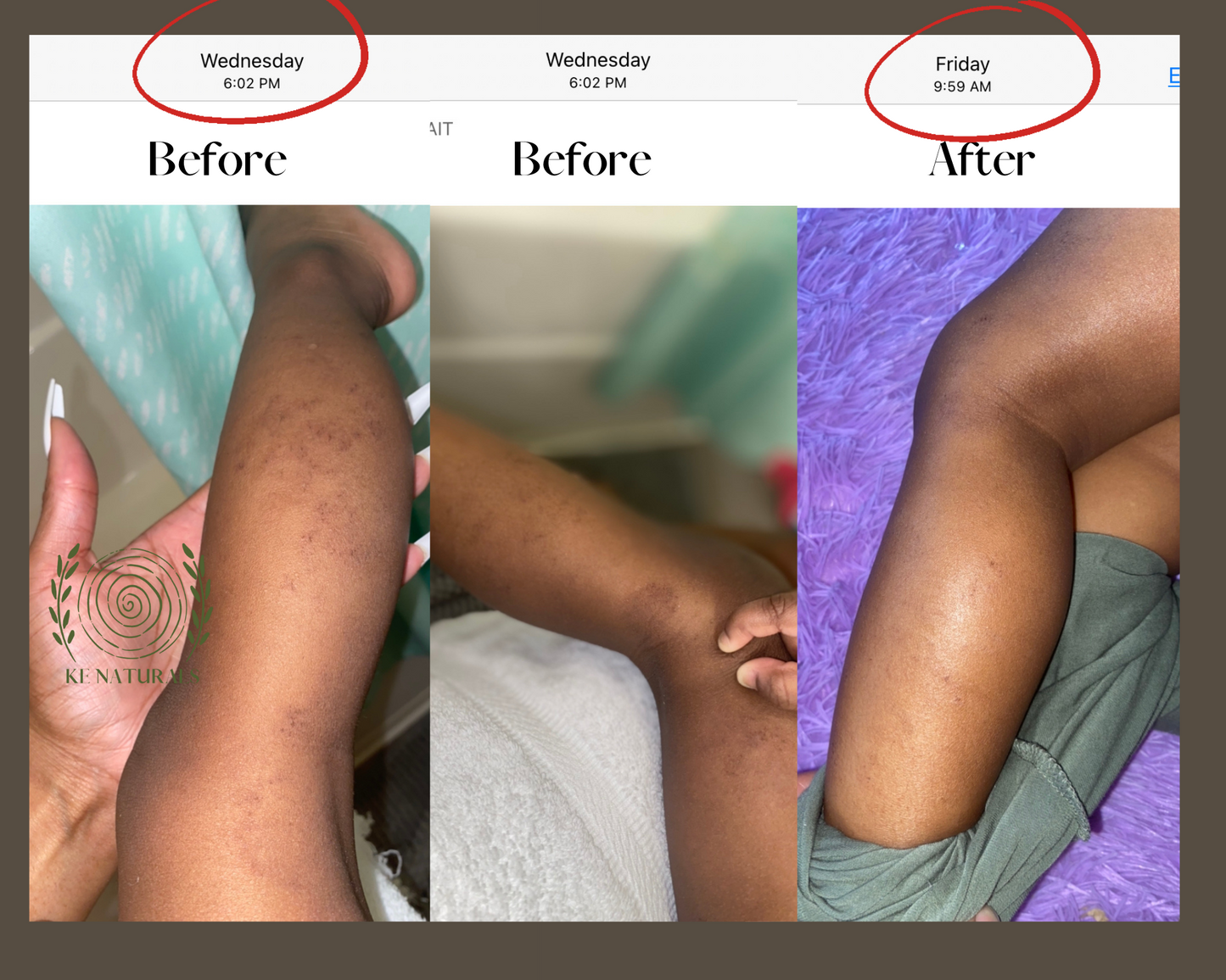 Gentle(Eczema)Collection